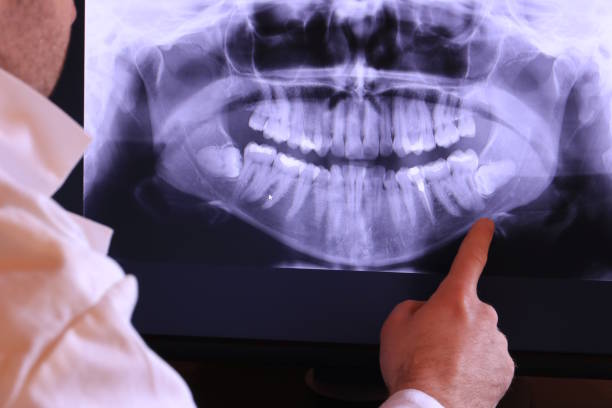 Best Pediatric Emergency Dentist in Kearny, AZ